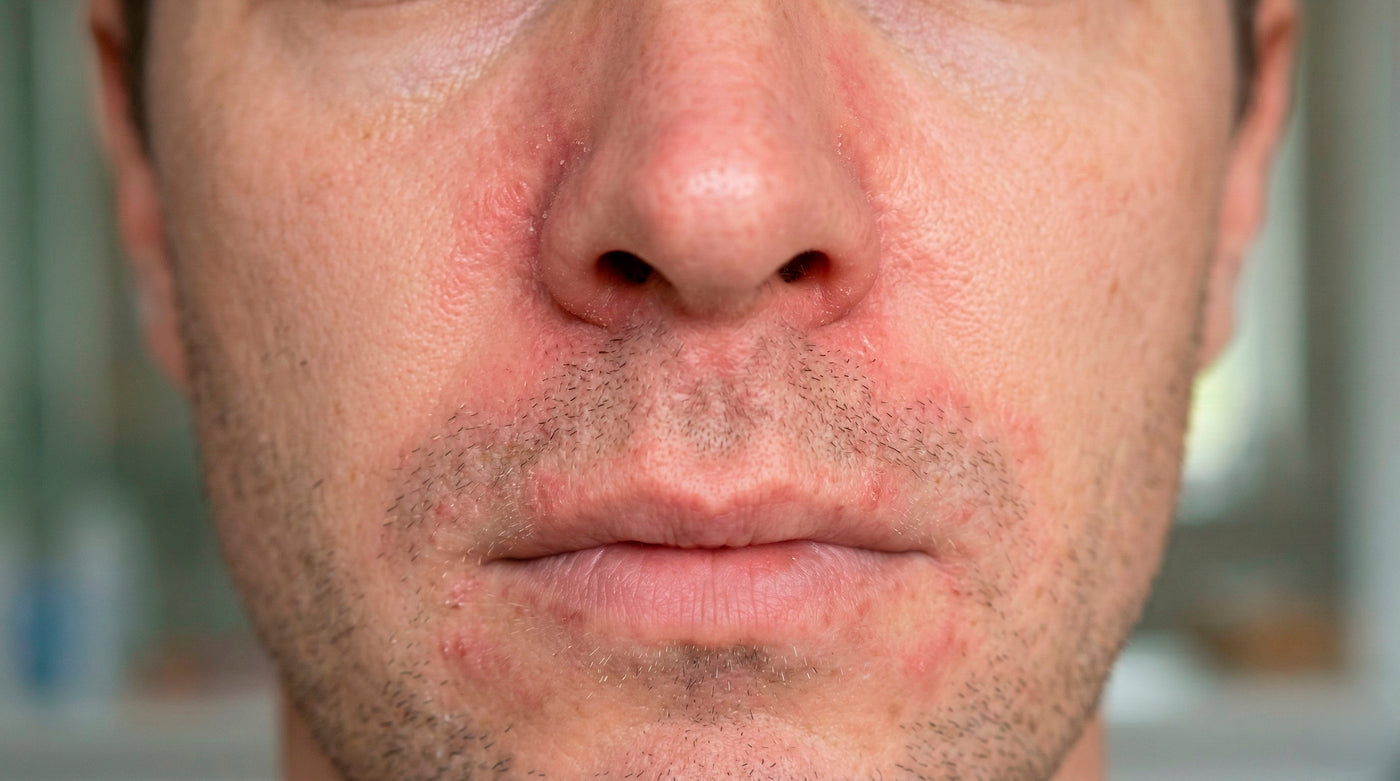 Before transformation